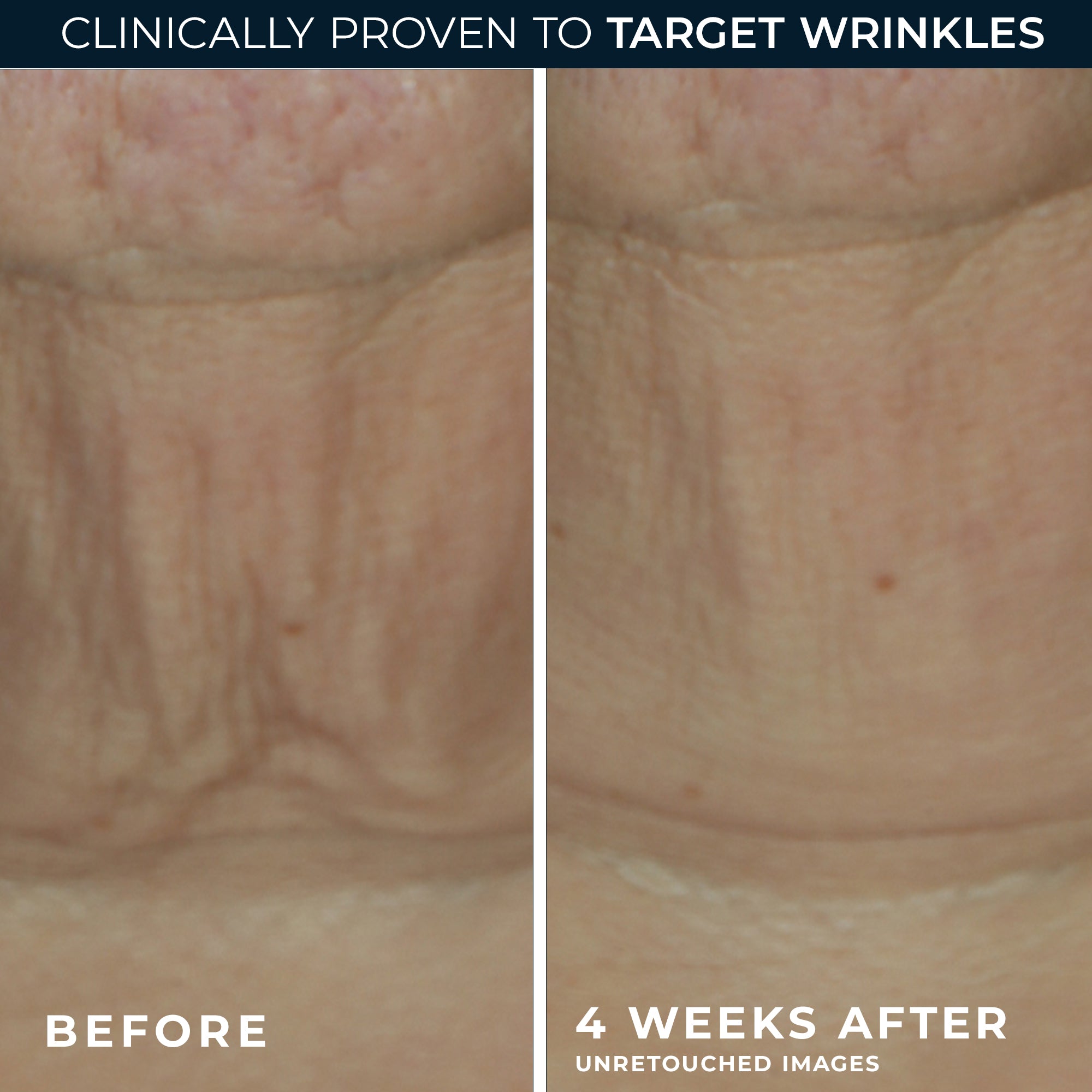 DERM CORREXION® Firming Serum Stick - Image 5