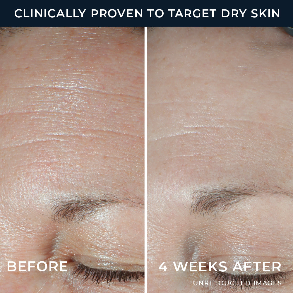 Hydration+ Moisturizer - Image 4