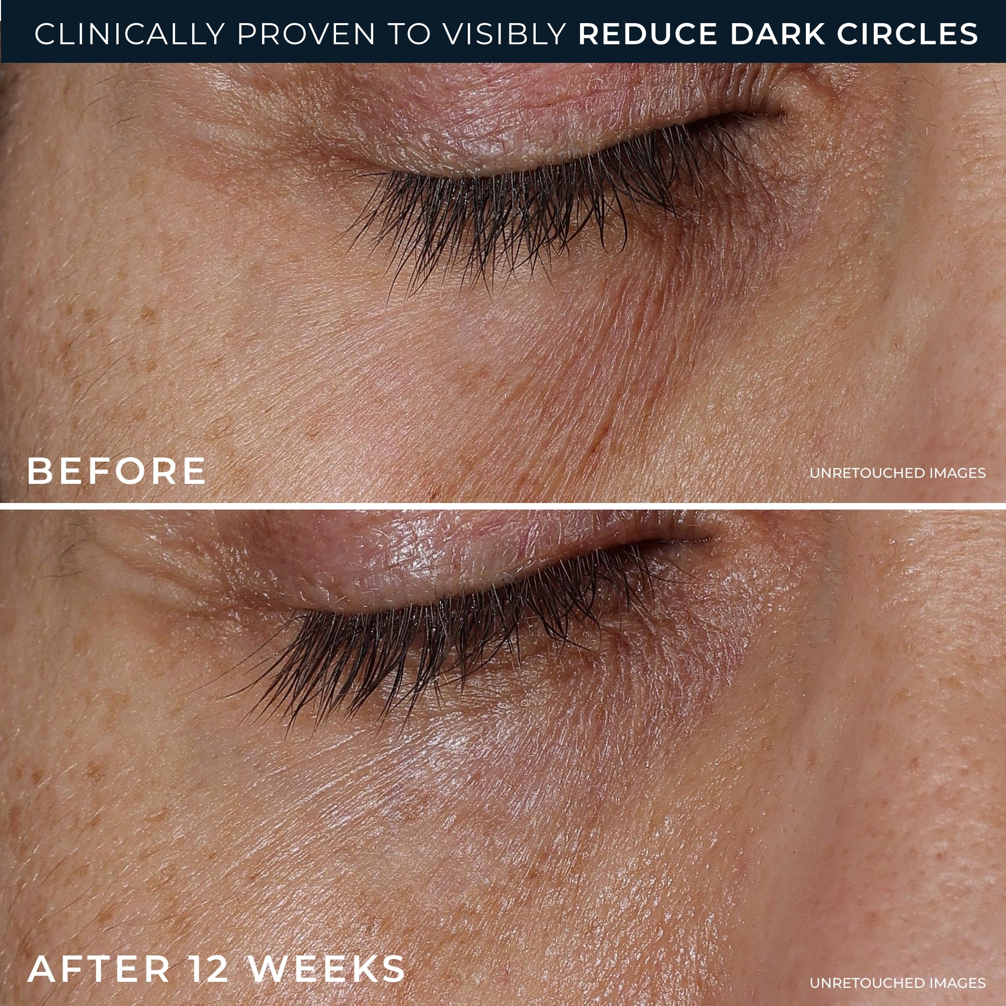 DERM CORREXION® Eye Repair Dark Circle Cream - Image 4