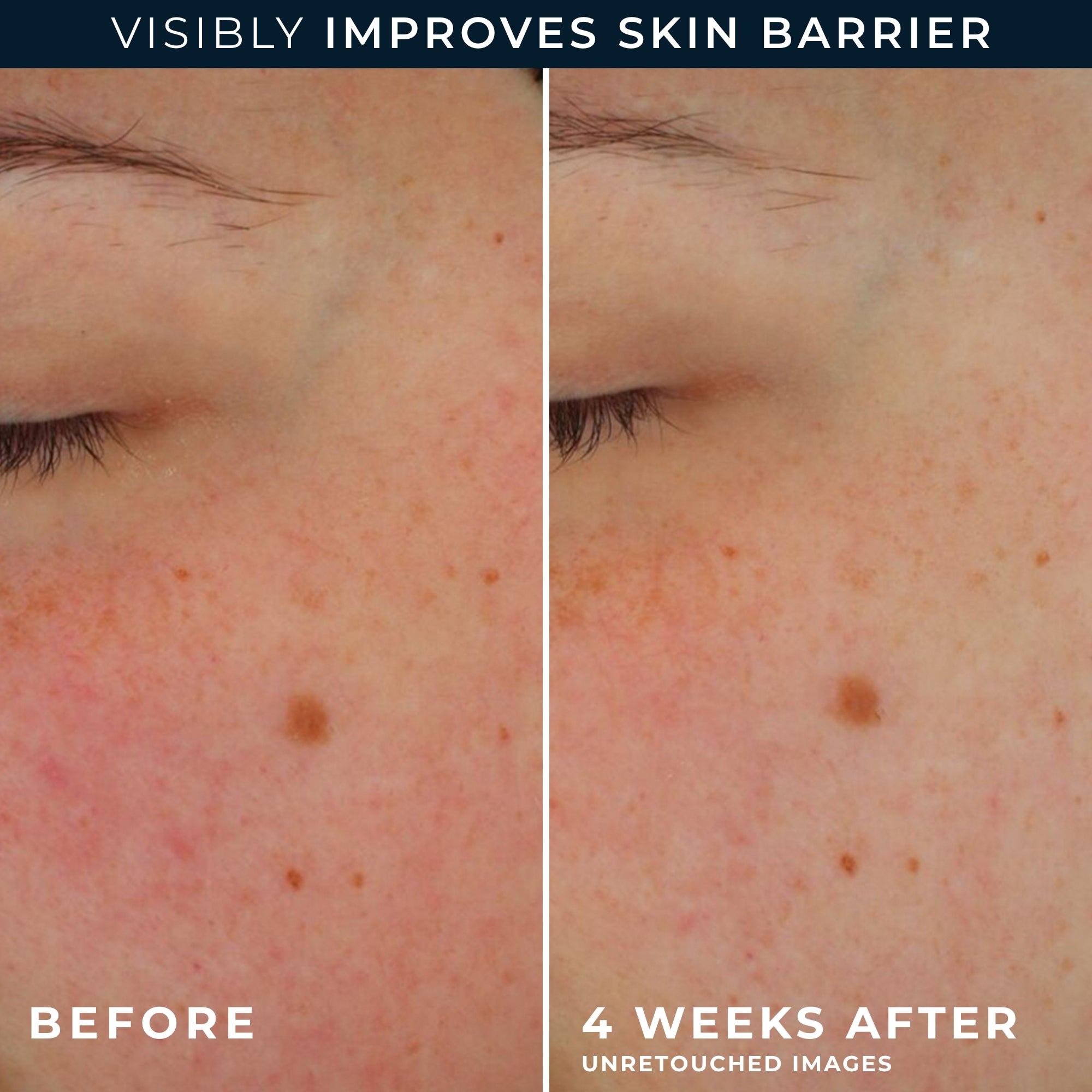 Barrier Renew® AM Moisturizer SPF 30 - Image 5