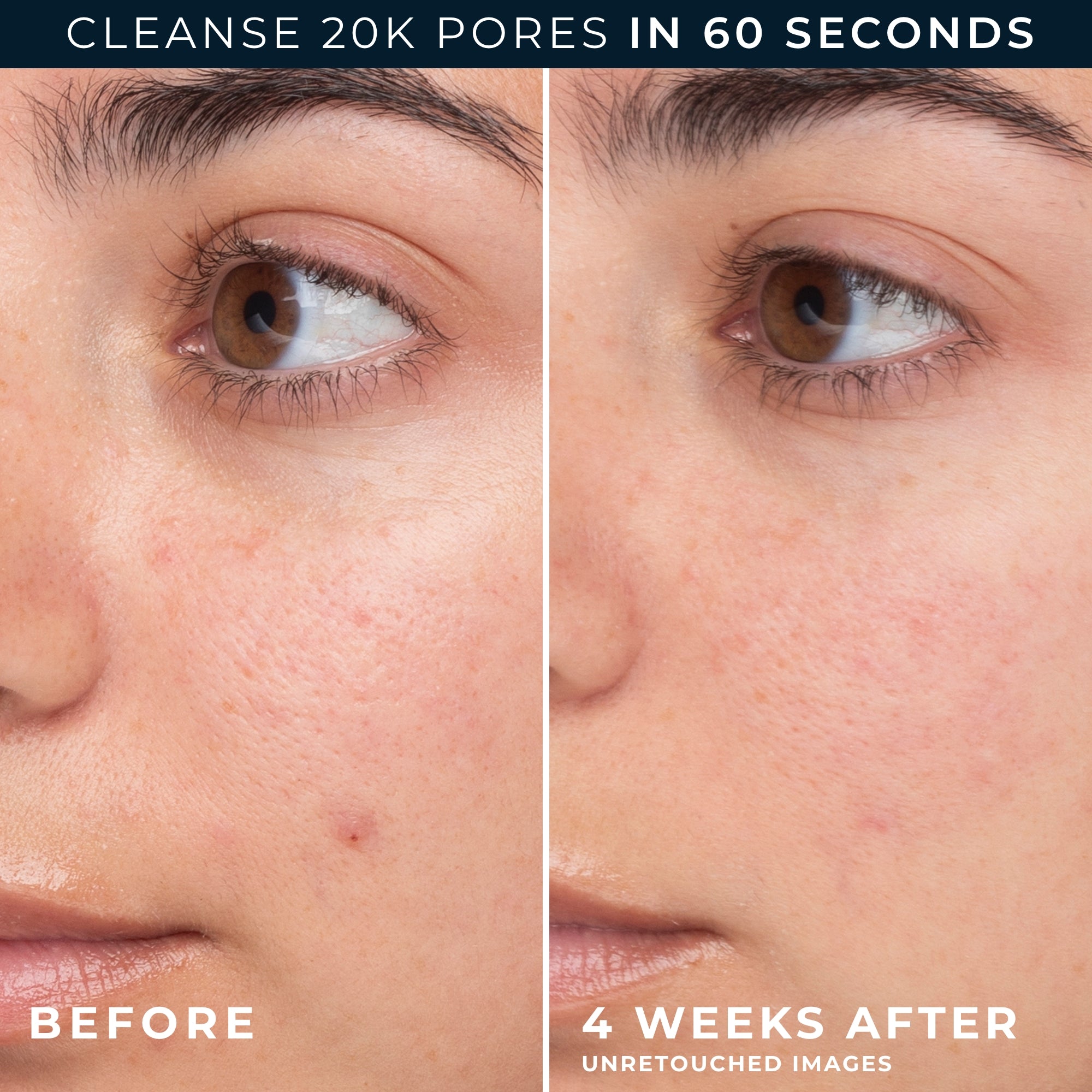 Barrier Renew® Gel-To-Foam Cleanser - Image 5