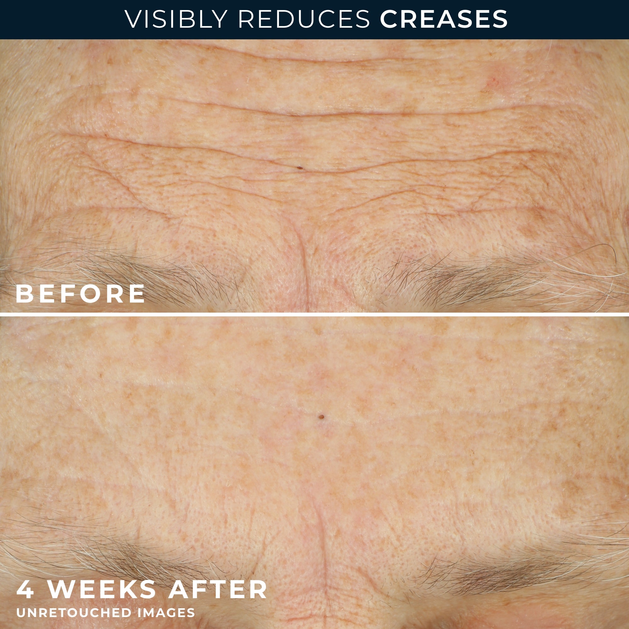 MULTI CORREXION® Crépe Repair Face & Neck Cream - Image 5