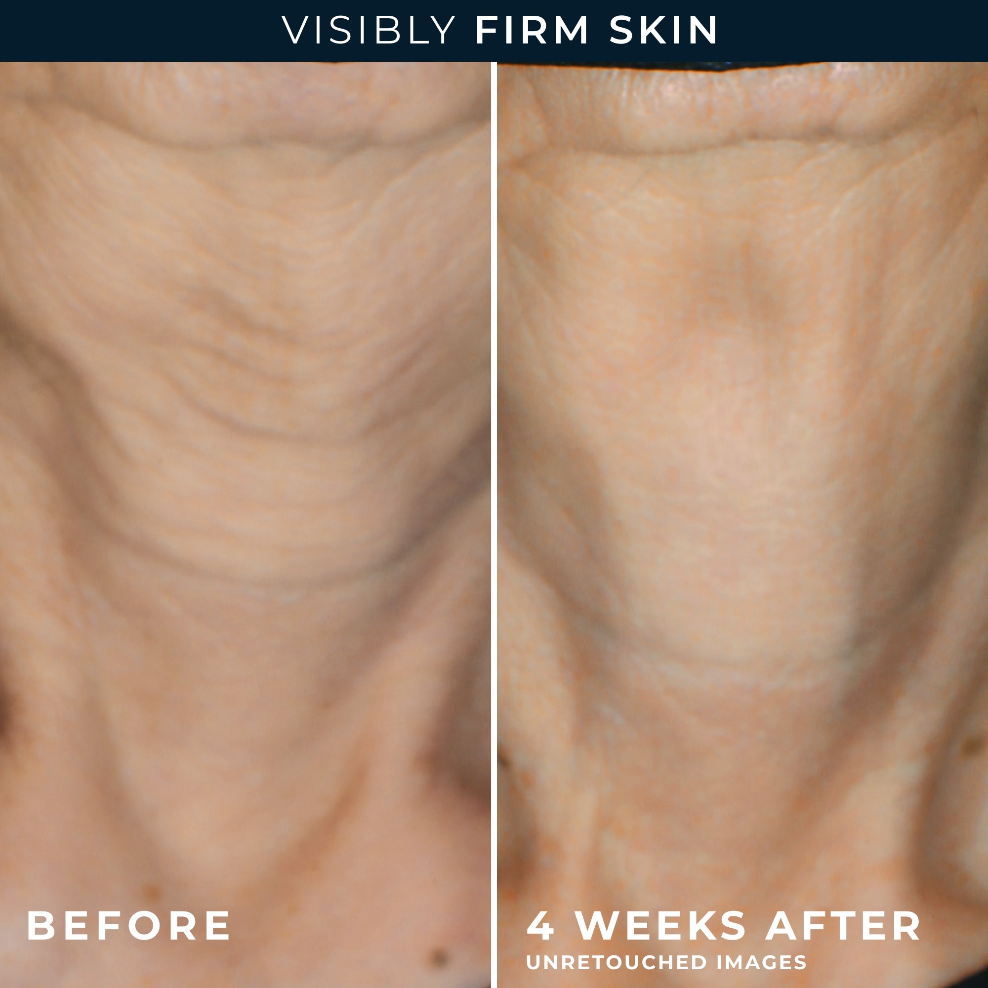 MULTI CORREXION® Crépe Repair Face & Neck Cream - Image 6