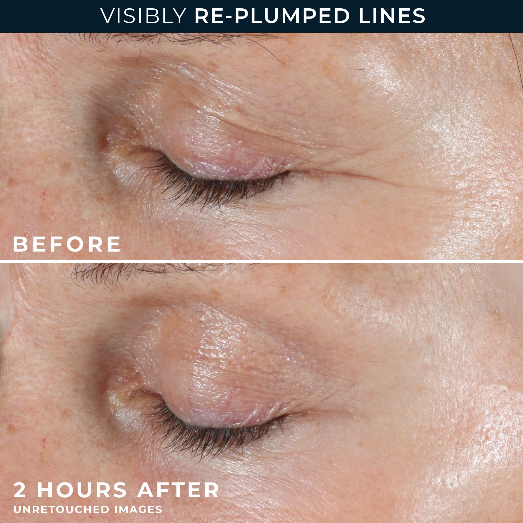 RETINOL CORREXION® Deep Wrinkle Targeted Patches - Image 5