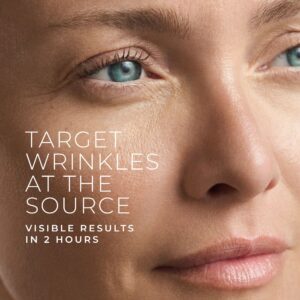 Alternative view of RETINOL CORREXION® Deep Wrinkle Targeted Patches