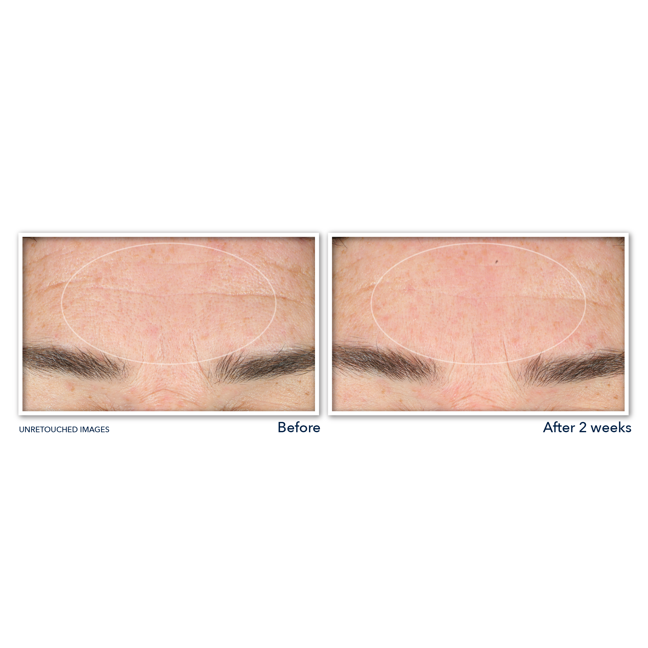 RETINOL CORREXION® Deep Wrinkle Serum Cleanser - Image 4