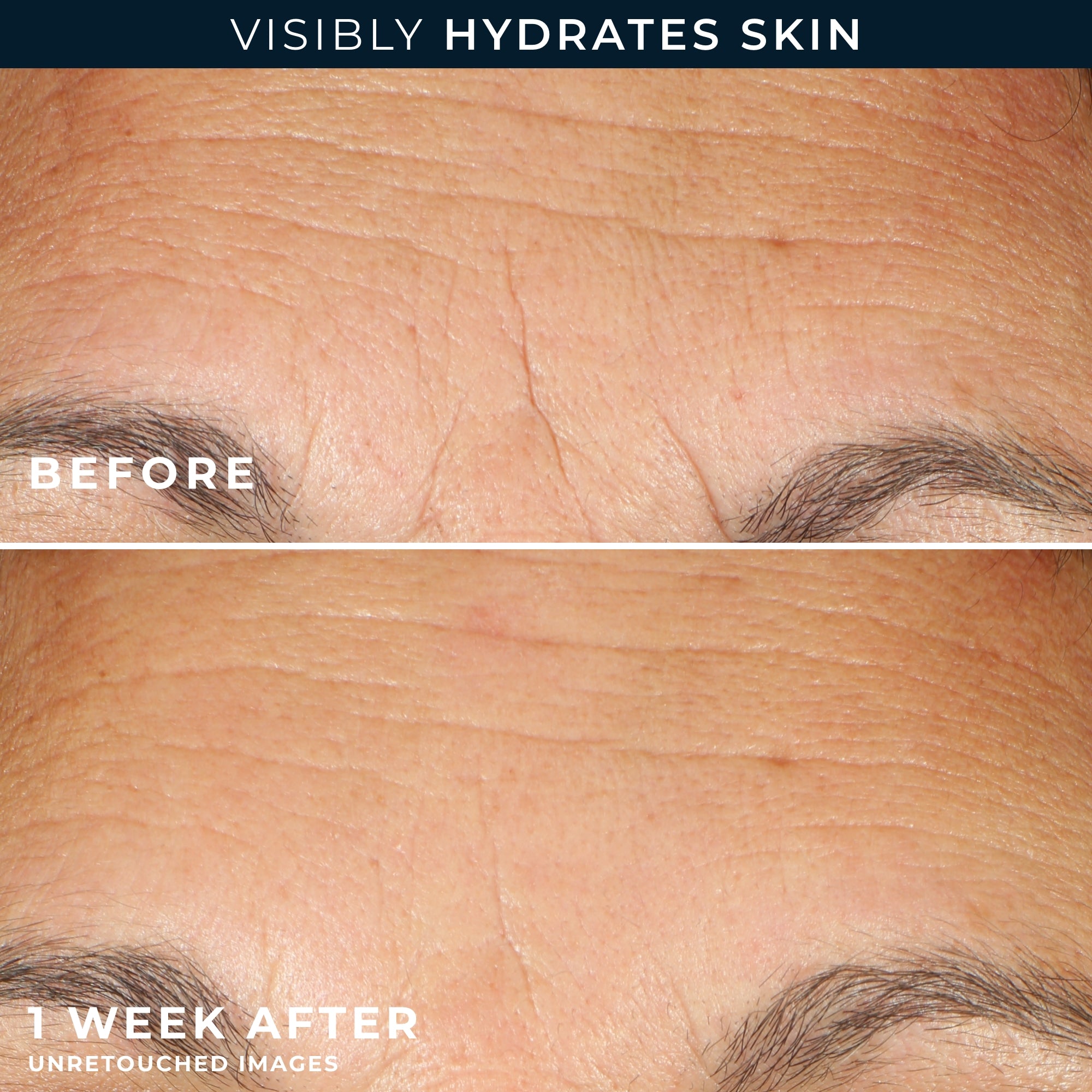 Hydration+ Serum Capsules - Image 5