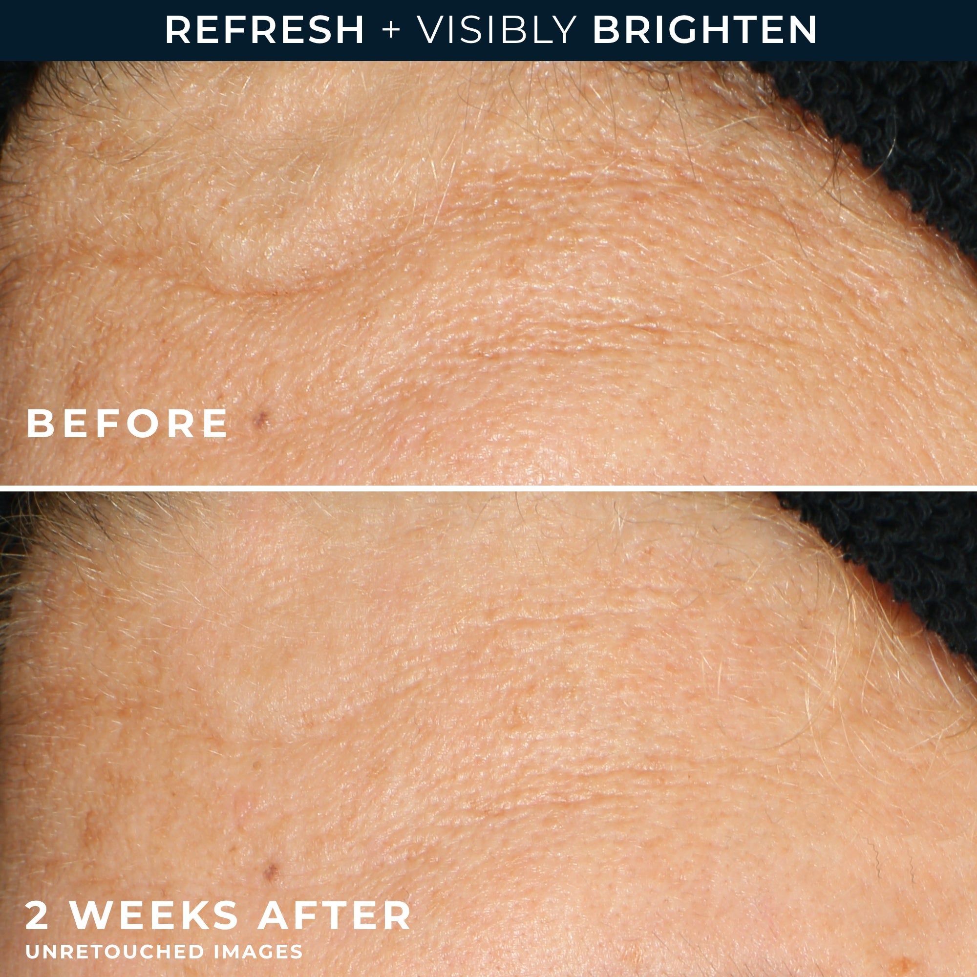 MULTI CORREXION® Revive + Glow Gel Cleanser - Image 5