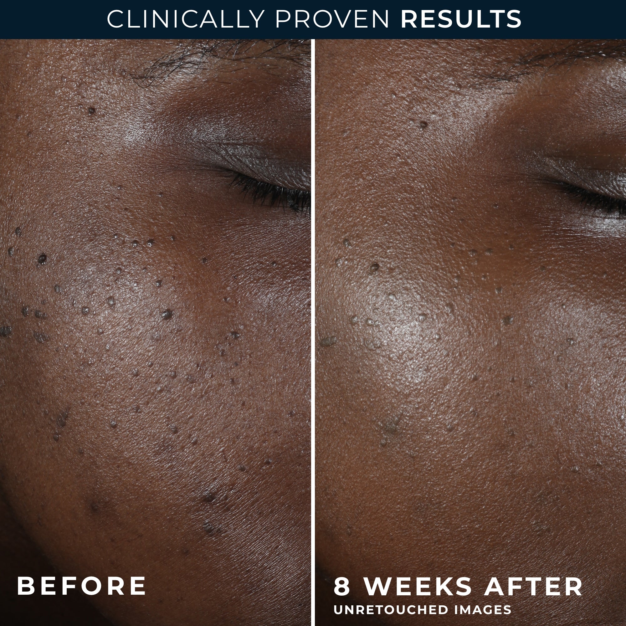 MULTI CORREXION® Even Tone + Lift Night Cream - Image 5