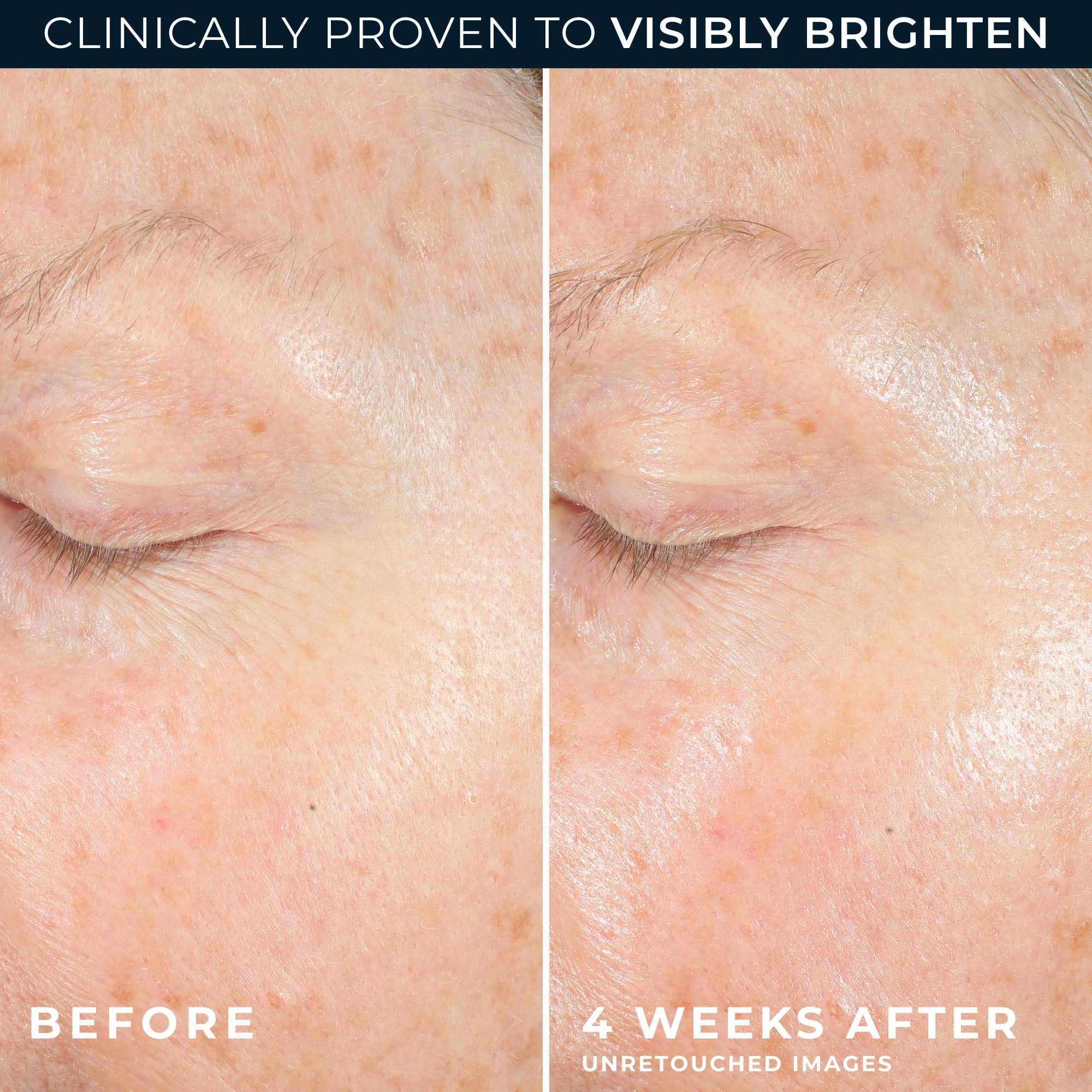 MULTI CORREXION® Revive + Glow Moisturizer - Image 5